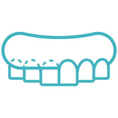 牙冠增長術-牙根覆蓋術-icon