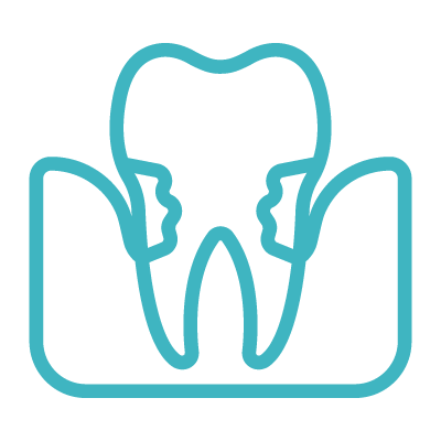 牙周植牙難症處理-icon