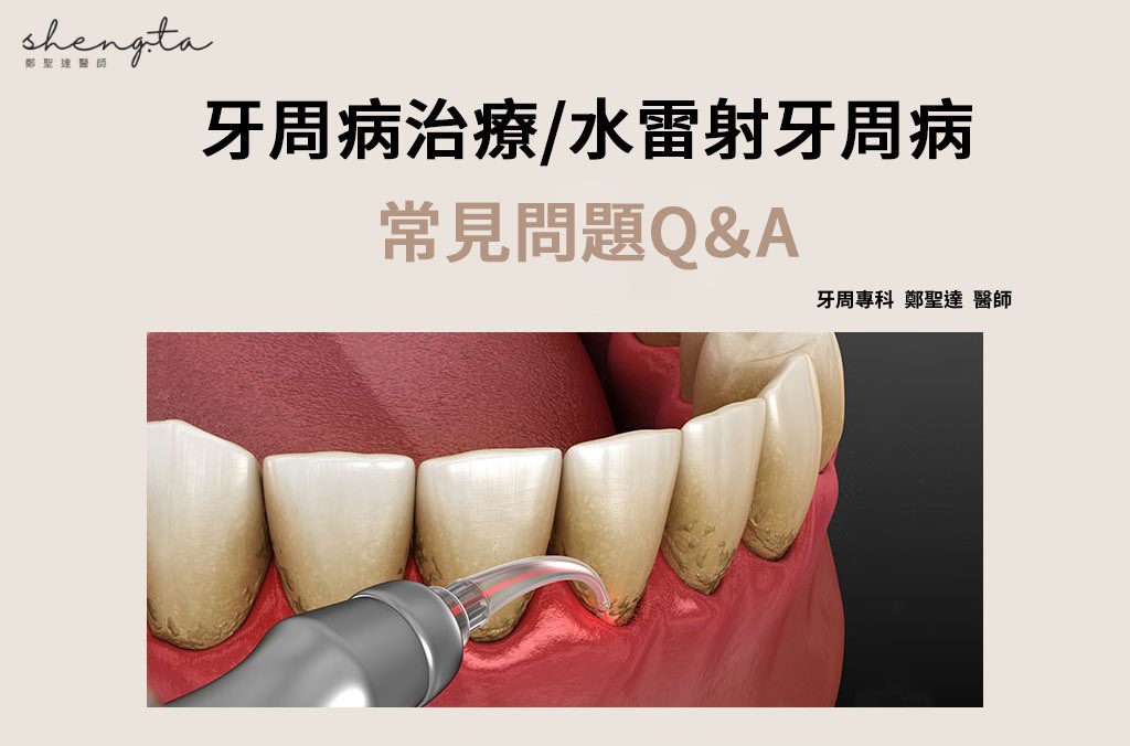 〈牙周病治療費用健保 〉彙整頁面 - 鄭聖達醫師｜台大牙周／植牙專科醫師｜台北水雷射牙周推薦