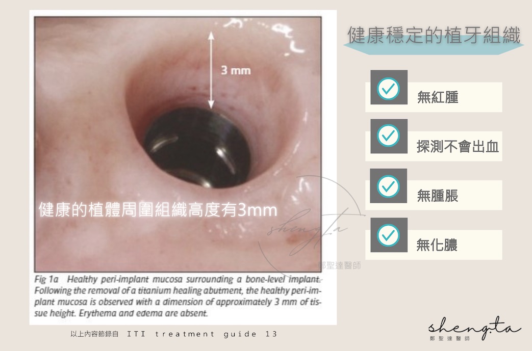 健康的植體周圍組織狀態：應沒有紅腫、探測出血、腫脹及化膿等症狀