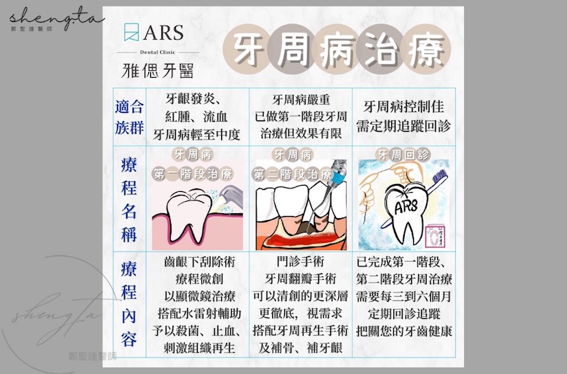 牙周病治療內容 - 第一階段牙周病治療(齒齦下刮除術)、第二階段牙周病手術(牙周翻瓣手術)、回診追蹤控制牙周病