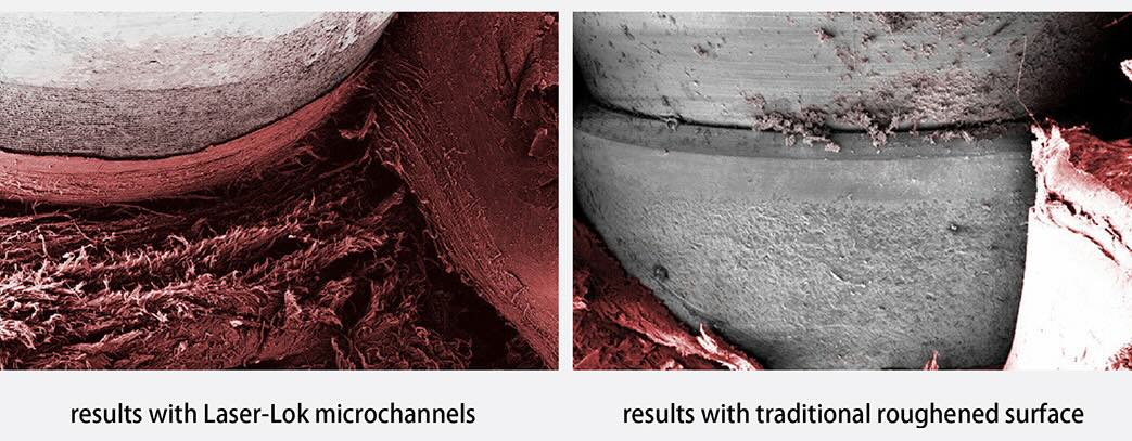 BioHorizons 百好植體（美國）：與傳統粗糙表面處理植體相比，百好植體的Laser-Lok技術可促進組織的生長與附著