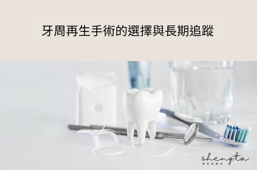 牙周再生手術-費用-成功率-牙周病專科醫師-台北-推薦-鄭聖達醫師